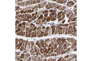 Immunohistochemical staining of human heart muscle with ZNF175 polyclonal antibody  shows strong cytoplasmic positivity in myocytes .