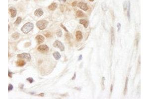 Immunohistochemistry (IHC) image for anti-Ubiquitin C (UBC) (AA 1-100) antibody (ABIN1683190) (UBC antibody  (AA 1-100))