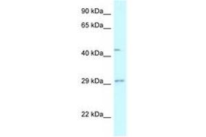Image no. 1 for anti-Fucosyltransferase 8 (Alpha (1,6) Fucosyltransferase) (FUT8) (AA 27-76) antibody (ABIN6747582) (FUT8 antibody  (AA 27-76))