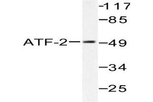 Image no. 2 for anti-Activating Transcription Factor 2 (ATF2) antibody (ABIN265319) (ATF2 antibody)