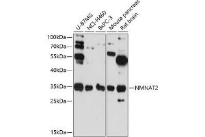 Western blot analysis of extracts of various cell lines, using NMN antibody (ABIN6129063, ABIN6144684, ABIN6144685 and ABIN6217965) at 1:3000 dilution.