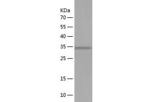 Western Blotting (WB) image for Natriuretic Peptide A (NPPA) (AA 25-150) protein (His-IF2DI Tag) (ABIN7283941) (NPPA Protein (AA 25-150) (His-IF2DI Tag))