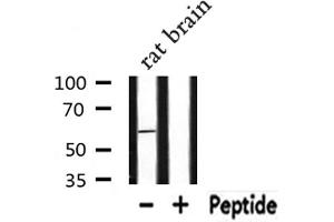 Western blot analysis of extracts from Rat brain lysate, using RAB11FIP2 antibody. (RAB11FIP2 antibody  (Internal Region))