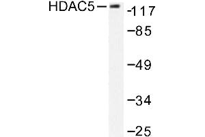 Image no. 1 for anti-Histone Deacetylase 5 (HDAC5) antibody (ABIN265456) (HDAC5 antibody)