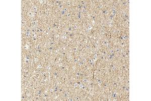 IHC analysis of UBE3A using anti-UBE3A antibody (ABIN7599562). (ube3a antibody  (AA 1-860))