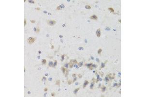 Immunohistochemistry (Paraffin-embedded Sections) (IHC (p)) image for anti-ISG15 Ubiquitin-Like Modifier (ISG15) (AA 1-165) antibody (ABIN3021653)