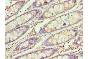 Immunohistochemistry of paraffin-embedded human colon tissue using ABIN7171070 at dilution of 1:100 (SMARCB1 antibody  (AA 86-385))
