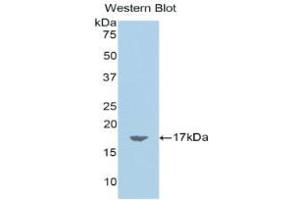 Western blot analysis of the recombinant protein. (Chemerin antibody  (AA 25-152))