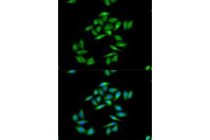 Immunofluorescence (IF) image for anti-Carnitine Palmitoyltransferase 1A (Liver) (CPT1A) antibody (ABIN1876495) (CPT1A antibody)
