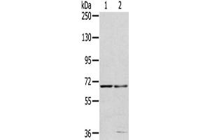 Gel: 6 % SDS-PAGE,Lysate: 40 μg,Lane 1-2: 293T cells, HepG2 cells,Primary antibody: ABIN7191487(MMP24 Antibody) at dilution 1/200 dilution,Secondary antibody: Goat anti rabbit IgG at 1/8000 dilution,Exposure time: 40 seconds (MMP24 antibody)