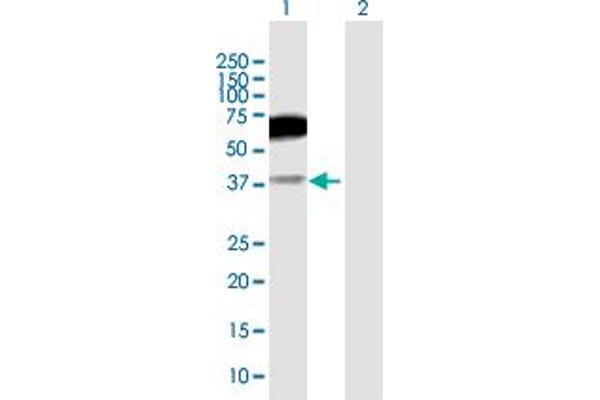 CD200R1 anticorps  (AA 1-348)