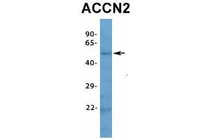 Host:  Rabbit  Target Name:  ACCN2  Sample Type:  Human Fetal Muscle  Antibody Dilution:  1. (ASIC1 antibody  (N-Term))