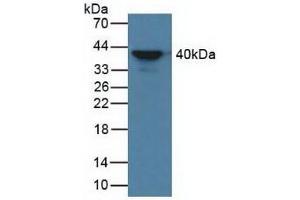 Detection of aZGP1 in Human Serum using Polyclonal Antibody to Alpha-2-Glycoprotein 1, Zinc Binding (aZGP1) (AZGP1 antibody  (AA 148-298))