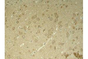 Immunohistochemistry (IHC) image for anti-Microtubule-Associated Protein tau (MAPT) (pThr205) antibody (ABIN7138801)
