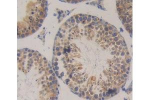 Used in DAB staining on fromalin fixed paraffin- embedded Kidney tissue (SRP9 antibody  (AA 2-86))
