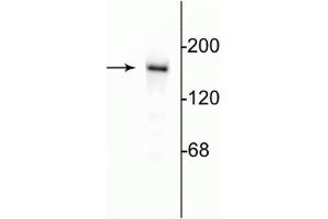 Western blot of 10 µg of rat hippocampal lysate showing specific immunolabeling of the ~180 kDa NR2B subunit of the NMDA receptor.