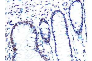 Immunohistochemistry (IHC) image for anti-Nuclear Mitotic Apparatus Protein 1 (NUMA1) antibody (ABIN7269002)