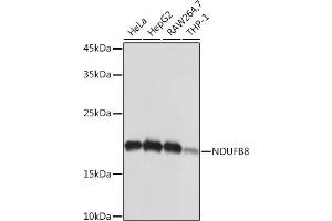 Western blot analysis of extracts of various cell lines, using NDUFB8 Rabbit mAb (ABIN7268813) at 1:1000 dilution. (NDUFB8 antibody)