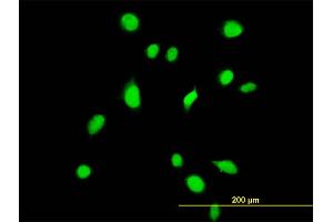 Immunofluorescence of monoclonal antibody to TBX6 on HeLa cell. (T-Box 6 antibody  (AA 191-299))