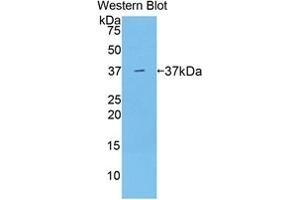 Detection of Recombinant ARG, Mouse using Polyclonal Antibody to Arginase (ARG) (ARG antibody  (AA 1-323))