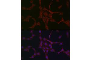 Immunofluorescence analysis of PC-12 cells using NBR1 Rabbit pAb (ABIN1680974, ABIN3018329 and ABIN3018330) at dilution of 1:50 (40x lens). (NBR1 antibody)