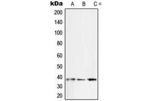 Western blot analysis of SFRP2 expression in SKNSH (A), Jurkat (B), A431 (C) whole cell lysates. (SFRP2 antibody  (Center))