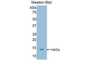 Detection of Recombinant IL1R1, Human using Polyclonal Antibody to Interleukin 1 Receptor Type I (IL1R1) (IL1R1 antibody  (AA 226-318))