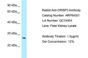 Western Blotting (WB) image for anti-Cysteine-Rich Secretory Protein 3 (CRISP3) (N-Term) antibody (ABIN2789797)