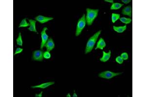 Immunofluorescence staining of HepG2 Cells with ABIN7127435 at 1:50, counter-stained with DAPI. (Recombinant PTGS2 antibody)