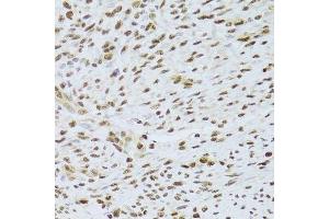 Immunohistochemistry (Paraffin-embedded Sections) (IHC (p)) image for anti-Acidic (Leucine-Rich) Nuclear phosphoprotein 32 Family, Member A (ANP32A) (AA 1-170) antibody (ABIN6136909)