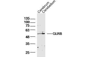 Lane 1: Mouse Cerebrum; Lane 2: Mouse Cerebellum lysates probed with GLRB Polyclonal Antibody, Unconjugated (bs-20450R) at 1:300 overnight at 4˚C.