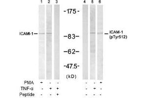 Image no. 1 for anti-Intercellular Adhesion Molecule 1 (ICAM1) (Tyr512) antibody (ABIN197276) (ICAM1 antibody  (Tyr512))