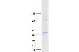Validation with Western Blot