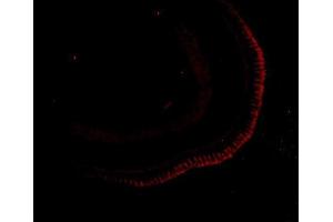 IF analysis of Siah1 using anti-Siah1 antibody (ABIN7603822).