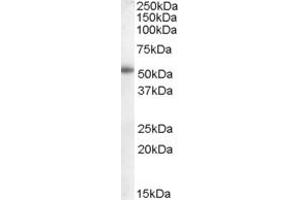 Western Blotting (WB) image for anti-Epithelial Splicing Regulatory Protein 2 (ESRP2) (N-Term) antibody (ABIN2156786) (ESRP2 antibody  (N-Term))