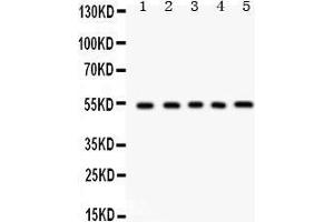 Anti- Vitronectin Picoband antibody, Western blotting All lanes: Anti Vitronectin  at 0. (Vitronectin antibody  (C-Term))