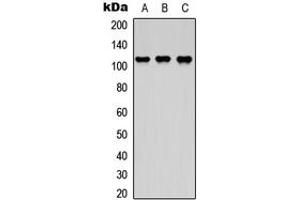 Western blot analysis of DDEF2 expression in HEK293T (A), NS-1 (B), H9C2 (C) whole cell lysates. (ASAP2 antibody  (Center))