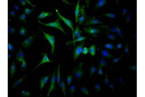 Immunofluorescence staining of Hela Cells with ABIN7127587 at 1:50, counter-stained with DAPI. (Recombinant JAK2 antibody)