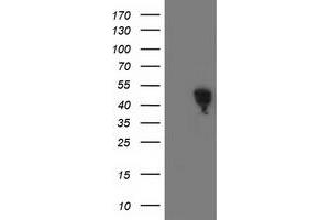 HEK293T cells were transfected with the pCMV6-ENTRY control (Left lane) or pCMV6-ENTRY SMS (Right lane) cDNA for 48 hrs and lysed. (SMS antibody)