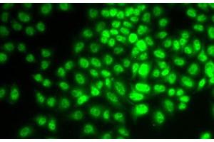 Immunofluorescence analysis of HeLa cells using CCNG1 Polyclonal Antibody (Cyclin G1 antibody)