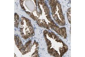 Immunohistochemical staining of human prostate with NDRG3 polyclonal antibody  strong cytoplasmic positivity in glandular cells. (NDRG3 antibody)