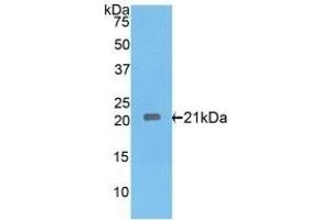 Detection of Recombinant IL17RE, Rat using Polyclonal Antibody to Interleukin 17 Receptor E (IL17RE) (IL17RE antibody  (AA 457-626))