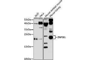Western blot analysis of extracts of various cell lines, using ZNF581 antibody (ABIN6128960, ABIN6150520, ABIN6150521 and ABIN6217055) at 1:3000 dilution.