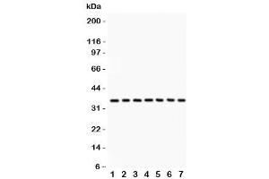 Western Blotting (WB) image for anti-Protein Phosphatase 2A Activator, Regulatory Subunit 4 (PPP2R4) (AA 1-309) antibody (ABIN3032389)