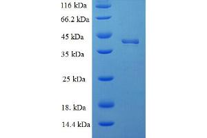 SDS-PAGE (SDS) image for Docking Protein 5 (DOK5) (AA 1-198), (Isoform 2) protein (His-SUMO Tag) (ABIN4976211)