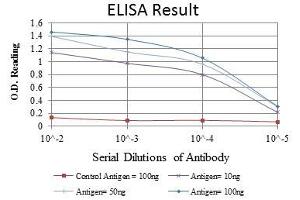 Red: Control Antigen (100 ng), Purple: Antigen (10 ng), Green: Antigen (50 ng), Blue: Antigen (100 ng), (Endoglin antibody)