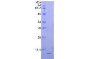 SDS-PAGE (SDS) image for beta-2-Microglobulin (B2M) ELISA Kit (ABIN6730891)