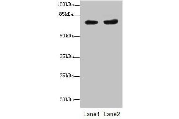 PGM2L1 antibody  (AA 101-400)