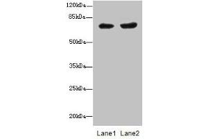 Western blot All lanes: PGM2L1 antibody at 0. (PGM2L1 antibody  (AA 101-400))