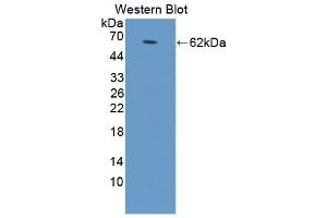 Detection of Recombinant STAR, Human using Polyclonal Antibody to Steroidogenic Acute Regulatory Protein (STAR) (STAR antibody  (AA 1-285))